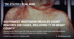 Southwest Wisconsin Measles Count Reaches 268 Cases, Including 77 in Grant County